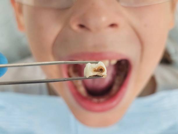 Best Emergency Gum Treatment in Gates Mills, OH