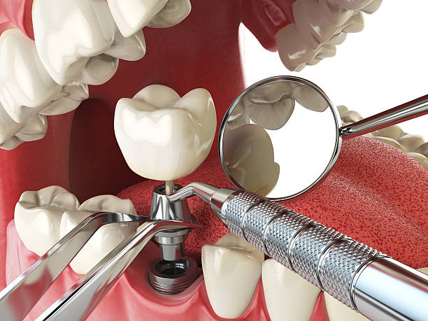 Best Emergency Dental Care for Broken or Chipped Teeth in Gates Mills, OH